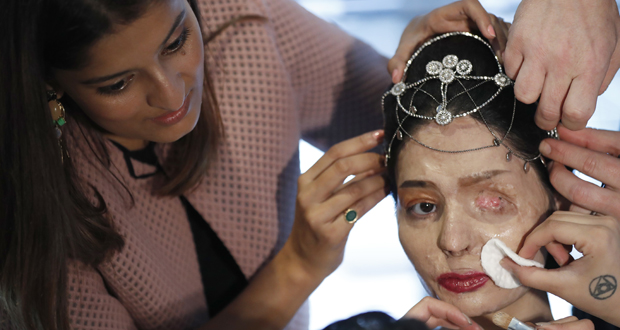 Qurishi is the face of Make Love Not Scars, a group that helps survivors of the gender-based crimes. Photo / AP